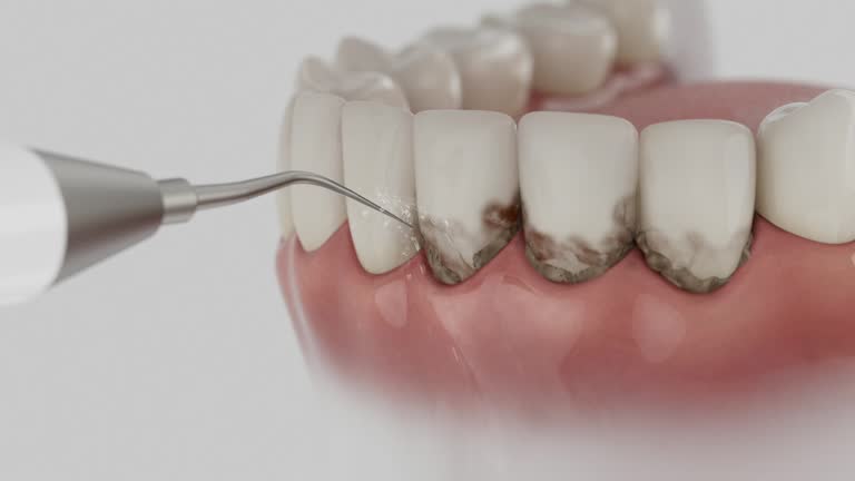 Reliable Dental contractor in Schertz, TX by Smile Center Dentistry